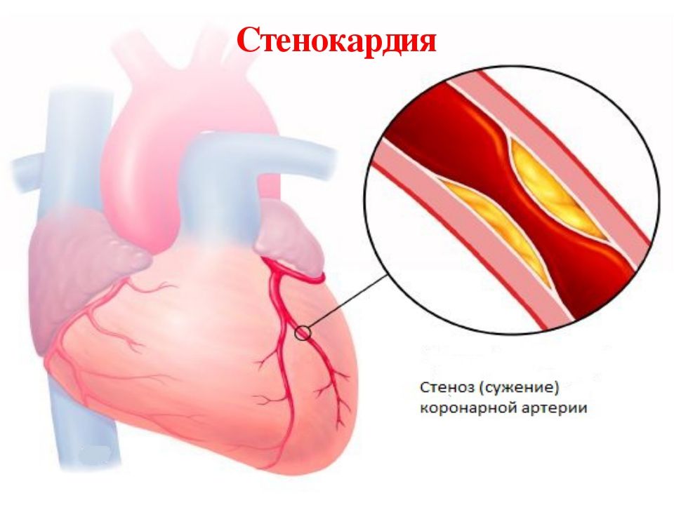 Какие пить травы чтобы не болело сердце thumbnail