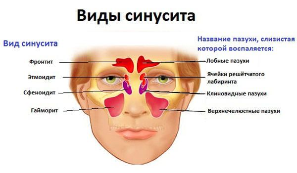 Промывание носа травами при отеке thumbnail