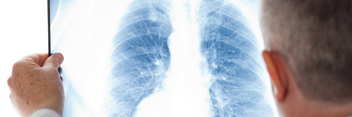 Народные средства лечения легких и дыхательных путей thumbnail